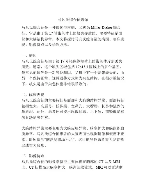 马凡氏综合征影像