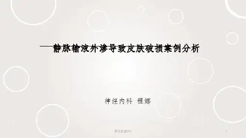 药物渗漏不良事件分析课件