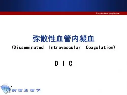 DIC