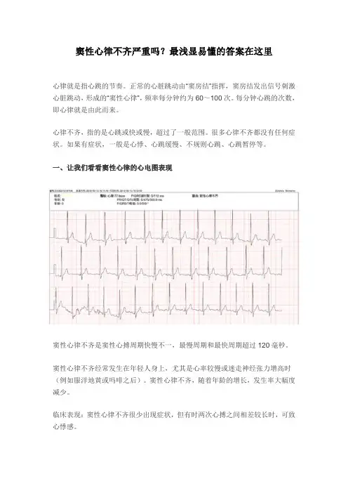 窦性心律不齐严重吗？最浅显易懂的答案在这里