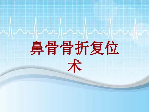 手术讲解模板：鼻骨骨折复位术