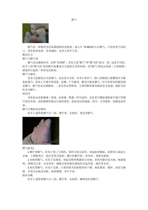 脚气百科