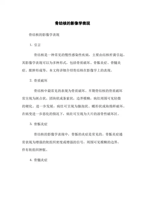 骨结核的影像学表现