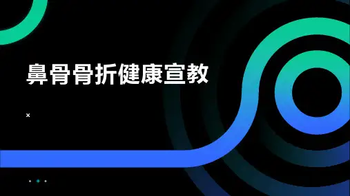 鼻骨骨折健康宣教