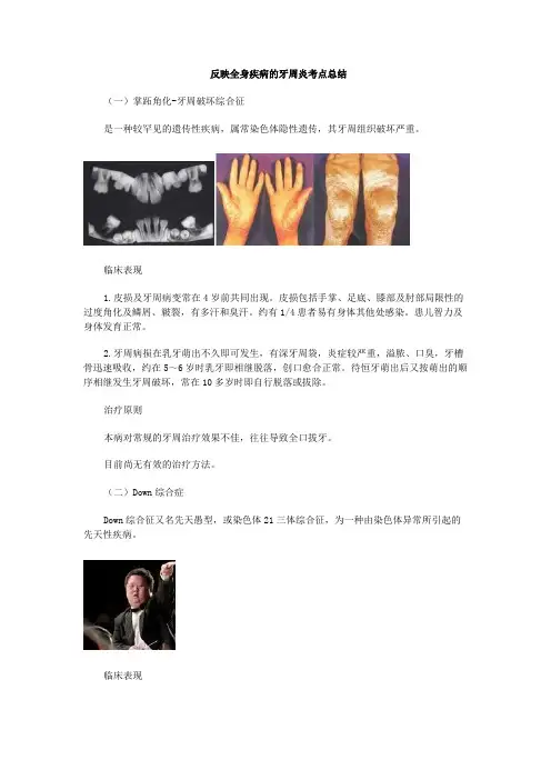 反映全身疾病的牙周炎考点总结