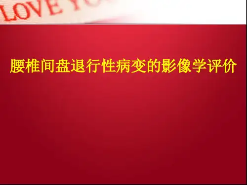 腰椎间盘退行性病变精品PPT课件