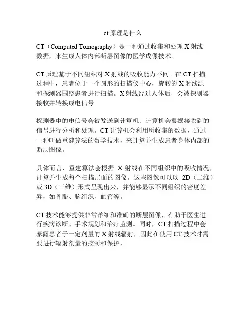 ct原理是什么