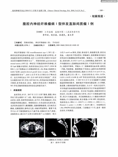 腹腔内神经纤维瘤病1型伴发直肠间质瘤1例