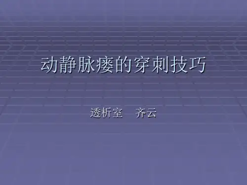 动静脉瘘的穿刺技巧