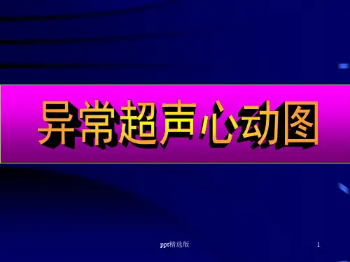 心脏彩超诊断ppt课件