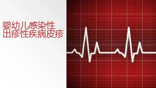 婴幼儿感染性出疹性疾病的鉴别诊断