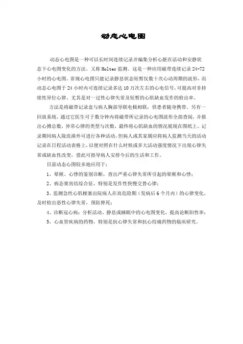 动态心电图