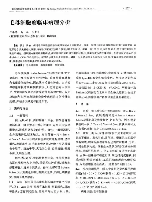 毛母细胞瘤临床病理分析