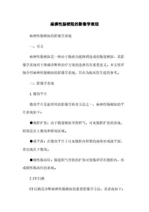麻痹性肠梗阻的影像学表现