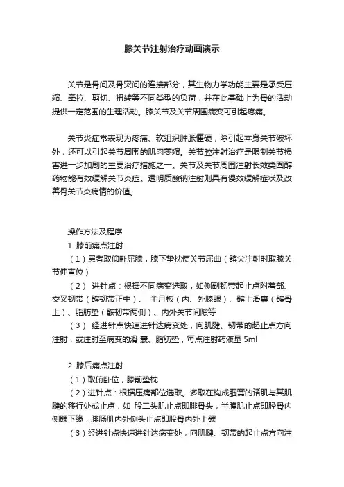 膝关节注射治疗动画演示