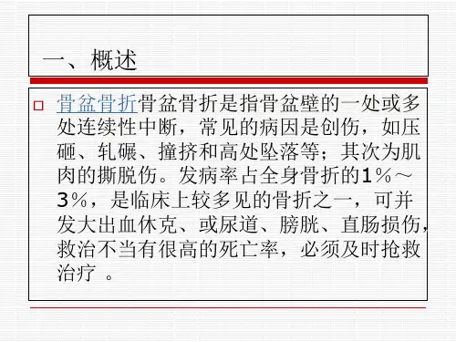 新骨盆骨折PPT课件