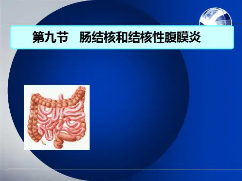 202X年肠结核和结核性腹膜炎-(6)详解