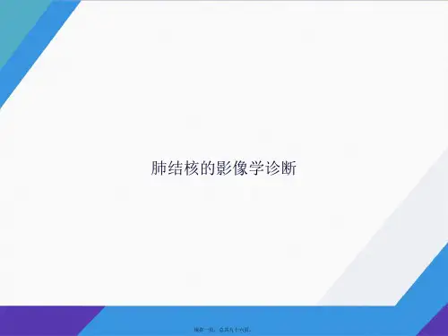 肺结核的影像学诊断讲课文档