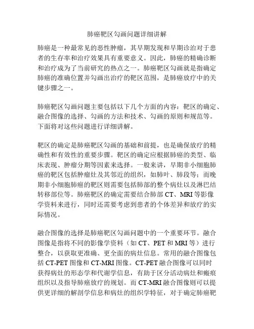 肺癌靶区勾画问题详细讲解 