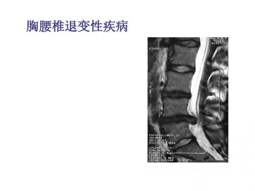 胸腰椎退变课件最新版