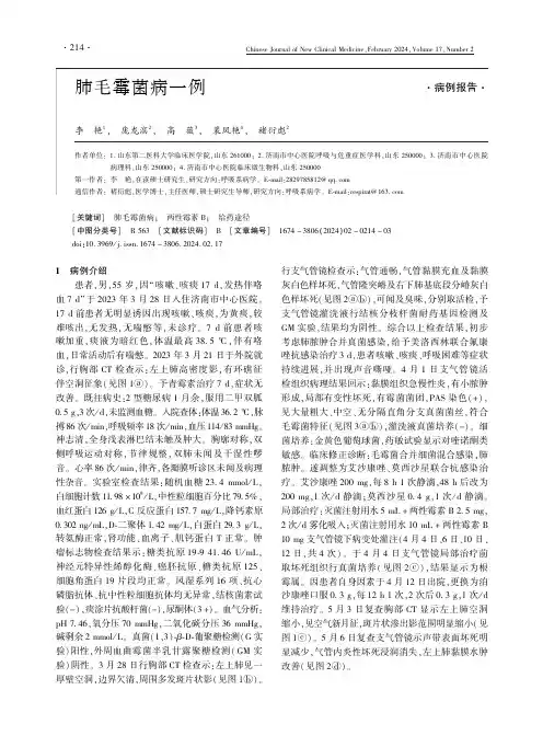 肺毛霉菌病一例