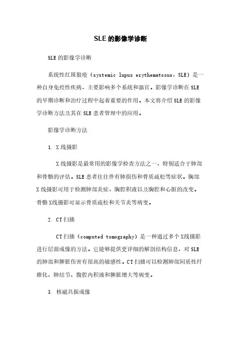 SLE的影像学诊断