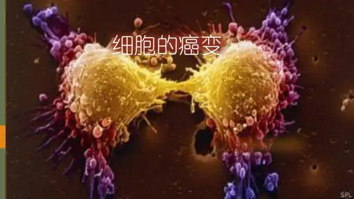 必修一细胞的癌变课件ppt13张