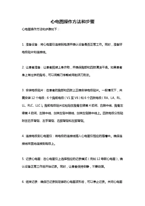 心电图操作方法和步骤