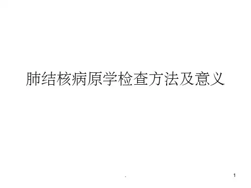 肺结核病原学检查方法及意义