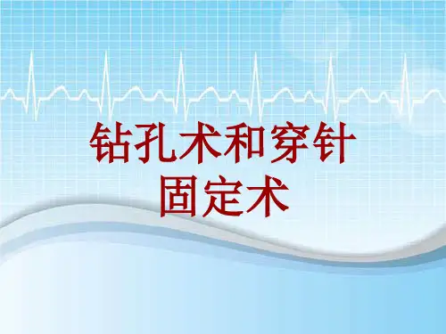 手术讲解模板：钻孔术和穿针固定术