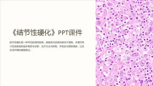 《结节性硬化》课件