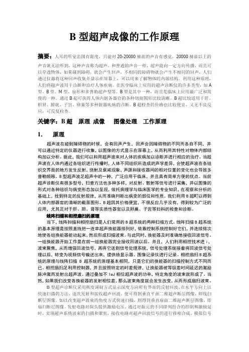 B型超声像工作原理