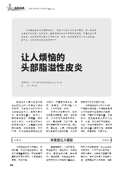 让人烦恼的头部脂溢性皮炎