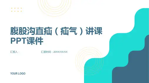 腹股沟直疝(疝气)讲课PPT课件