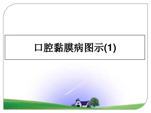 最新口腔黏膜病图示(1)PPT课件