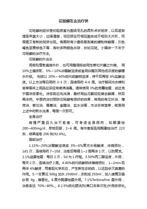 花斑癣怎么治疗快