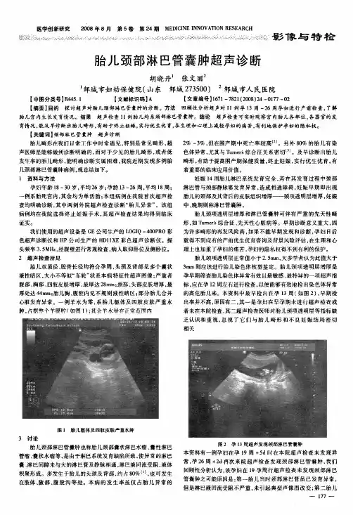 胎儿颈部淋巴管囊肿超声诊断