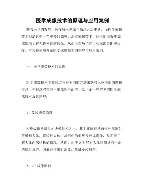 医学成像技术的原理与应用案例