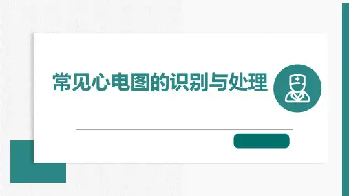 常见心电图的识别与处理