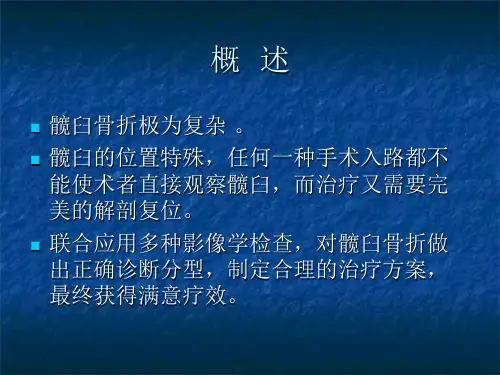 髋-臼-骨-折.ppt