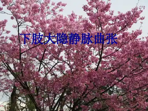 下肢大隐静脉曲张ppt课件