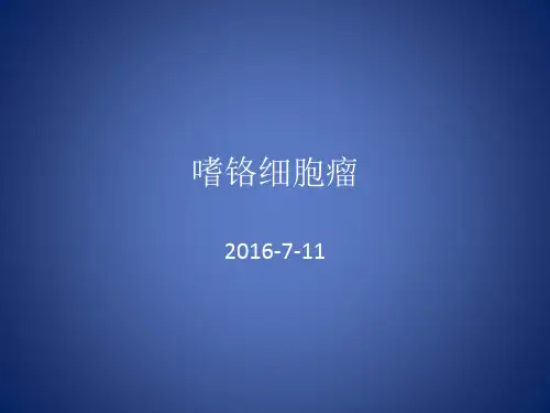 嗜铬细胞瘤精品PPT课件