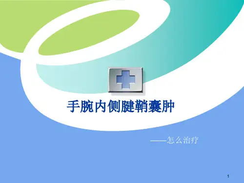 手腕内侧腱鞘囊肿PPT课件