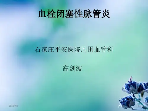 血栓闭塞性脉管炎PPT参考幻灯片