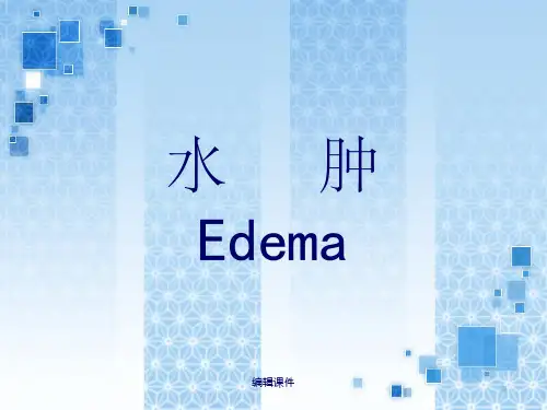 医院诊断学：水肿
