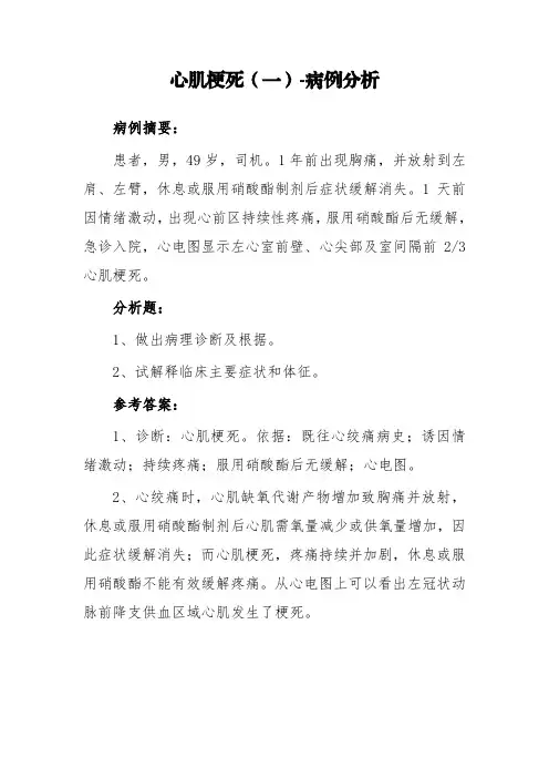 心肌梗死(一)-病例分析