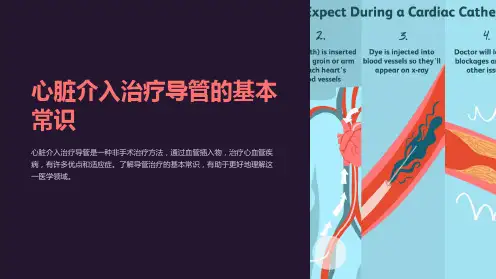 心脏介入治疗导管的基本常识