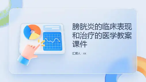 膀胱炎的临床表现和治疗的医学教案课件