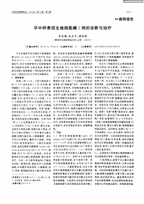 卒中样表现生殖细胞瘤2例的诊断与治疗