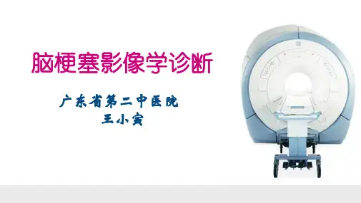 脑梗塞的影像学诊断